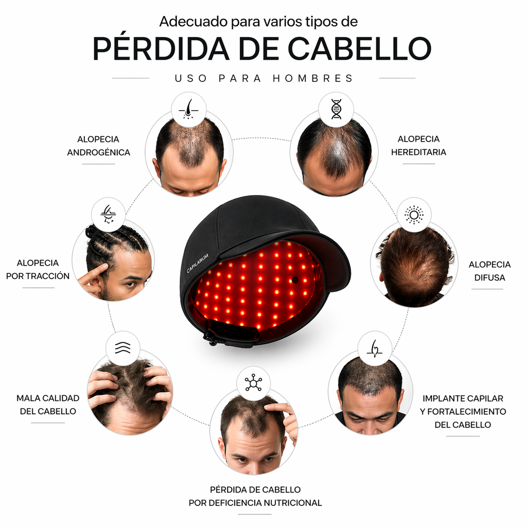 Capilarum X1 — Sistema de estimulación capilar en casa
